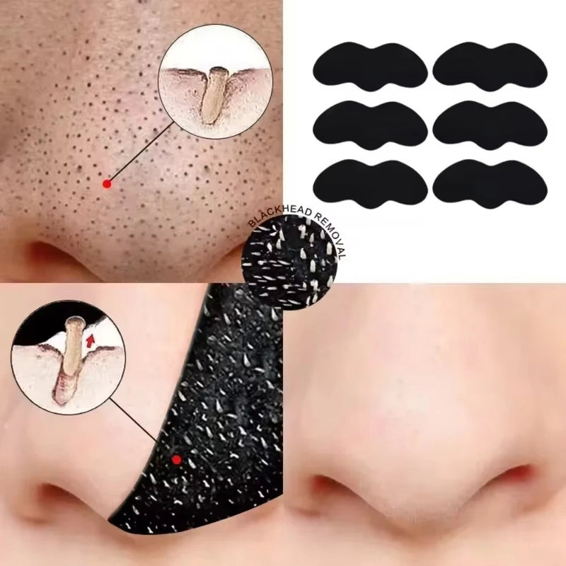 DermaStrip Pro - Tiras Removedoras de Cravos e Oleosidades